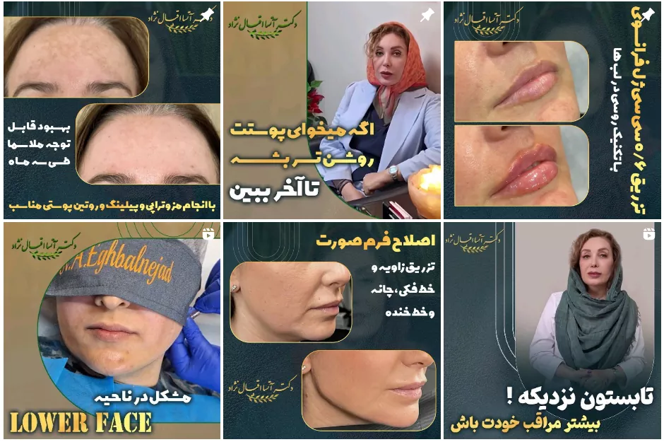 بهترین دکتر لیفت با نخ در اصفهان