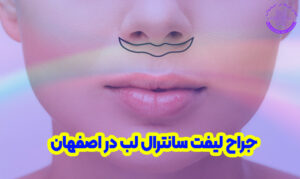 بهترین جراح لیفت سانترال لب در اصفهان