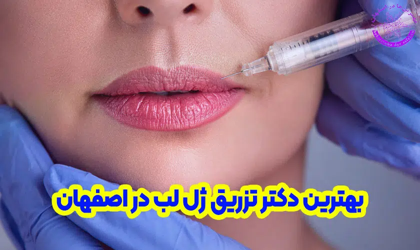 بهترین دکتر تزریق ژل لب در اصفهان