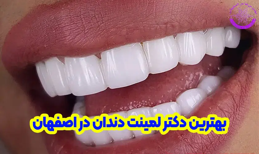 بهترین دکتر لمینت دندان در اصفهان