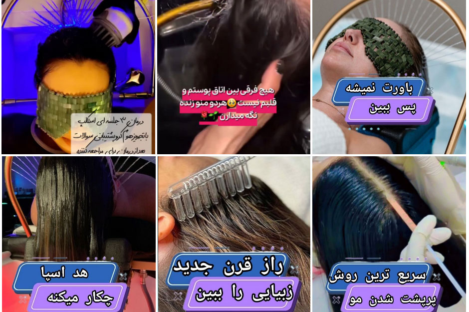 پاک ساری کف سر در اصفهان