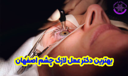 بهترین دکتر عمل لازک چشم در اصفهان