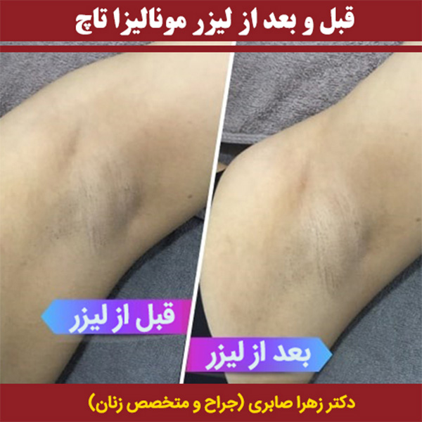 نمونه کار زهرا صابری