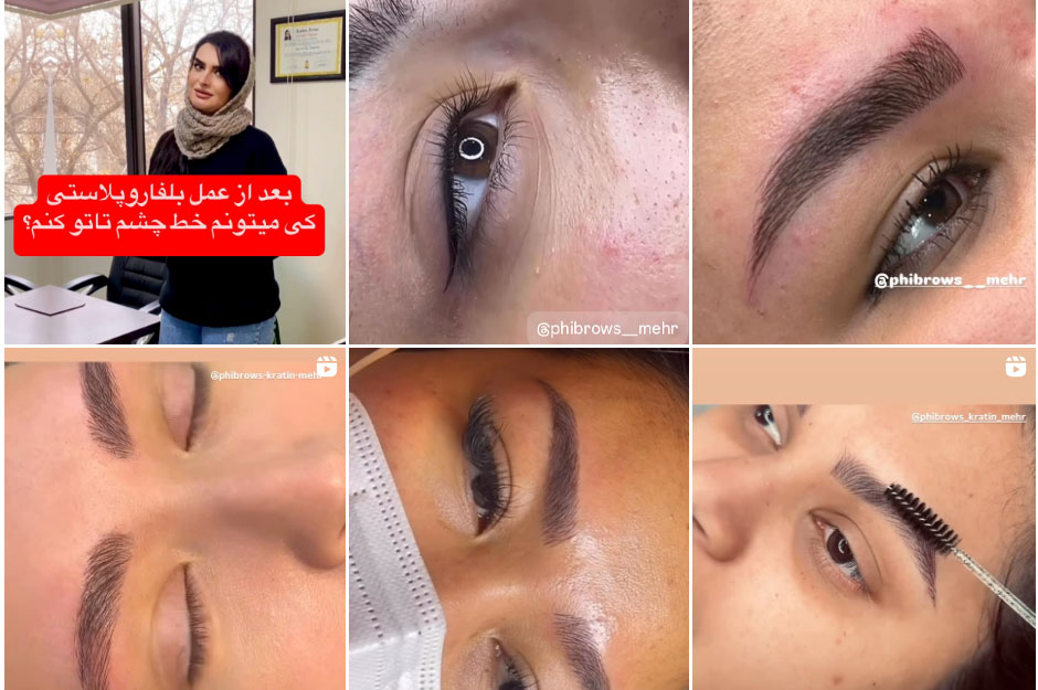 میکروبلیدینگ کار اصفهان