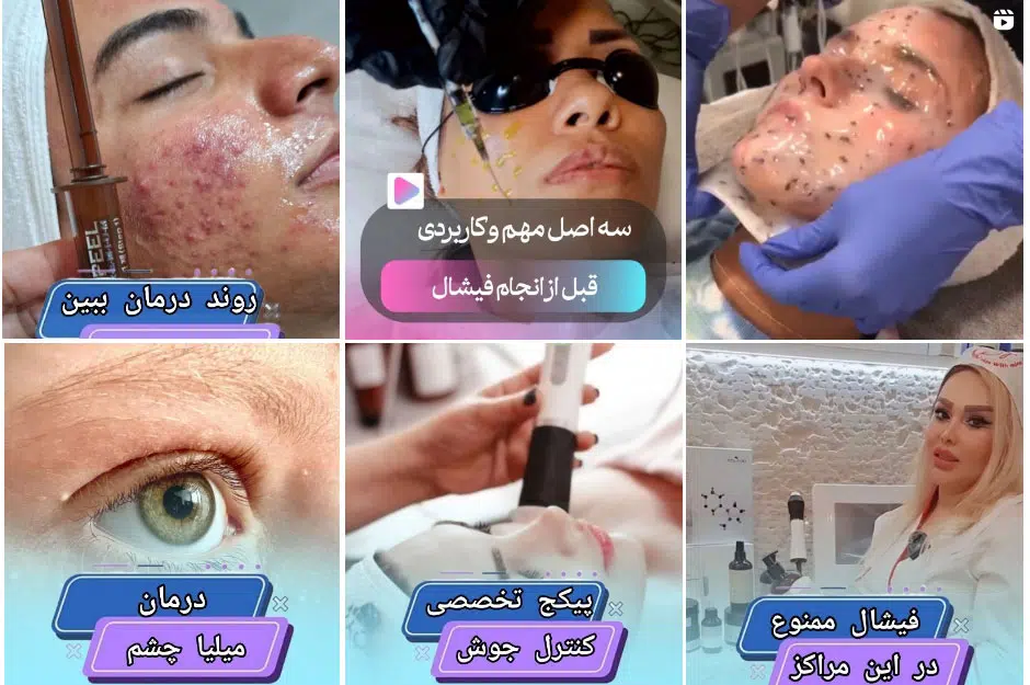 مرکز تخصصی پاکسازی پوست صورت در اصفهان