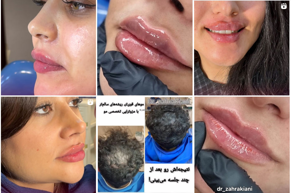 نمونه کار دکتر زهرا کیانی