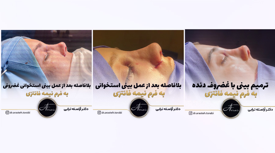 نمونه کار دکتر آراسته ترابی