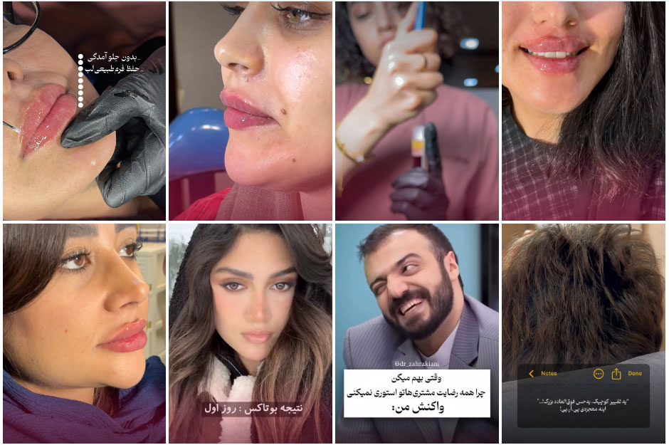 نمونه کارهای دکتر زهرا کیانی