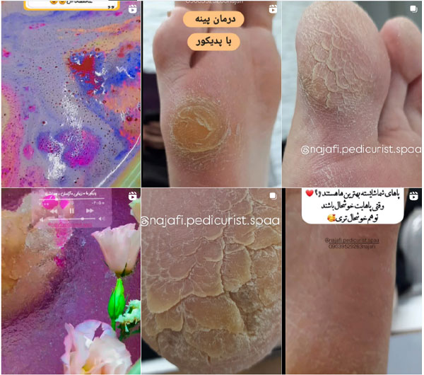 بهترین پدیکور در اصفهان