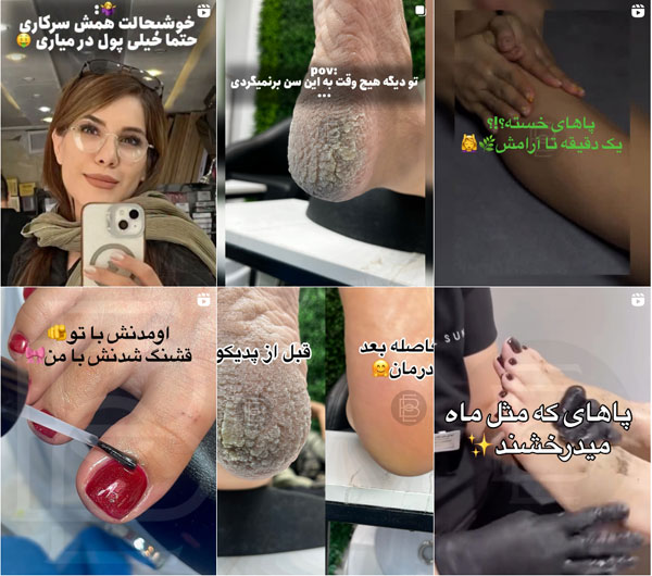 بهترین مرکز پدیکور ناخن در اصفهان