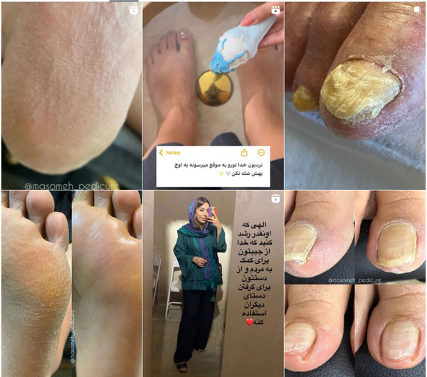 بهترین پدیکور کفسابی در اصفهان