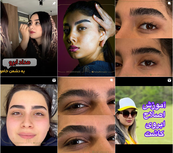 اصلاح ابروی کاشت در اصفهان