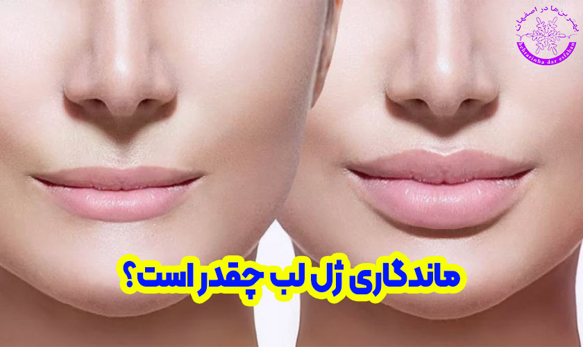 ماندگاری ژل لب چقدر است