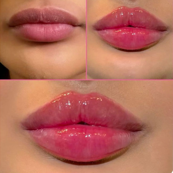 مدت زمان ماندگاری ژل لب