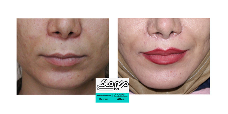 نمونه کار سانترال لب مریم ملکی