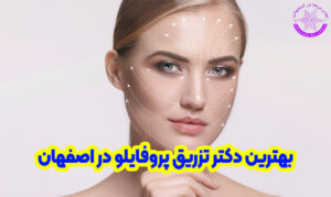 بهترین دکتر تزریق پروفایلو در اصفهان