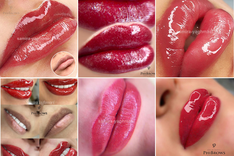 بهترین مرکز شیدینگ لب اصفهان