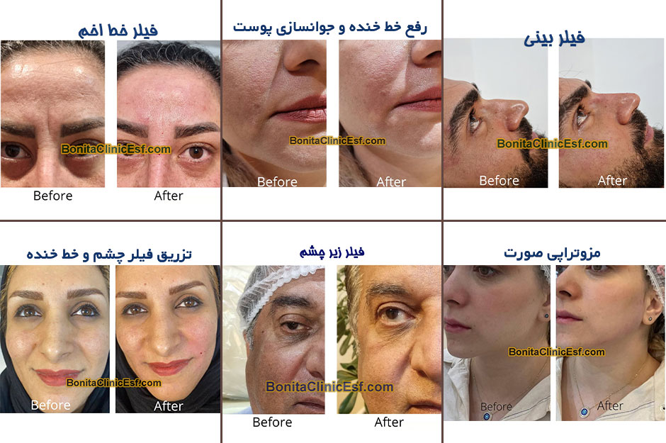 نمونه کارهای کلینیک بنیتا