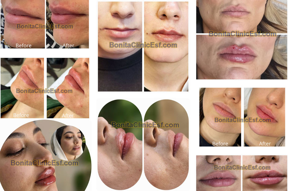 نمونه کارهای کلینیک بنیتا