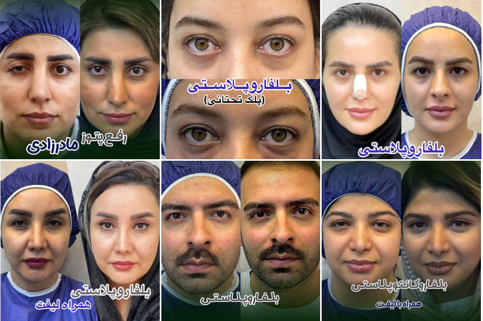 نمونه کارهای دکتر میلاد نیلچی