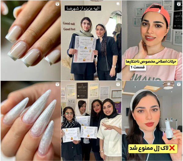 آموزش کاشت مو مریم برمه