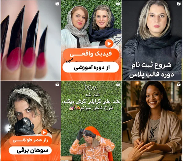 آموزش کاشت مو الهه شجاعی