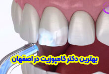 بهترین دکتر کامپوزیت دندان در اصفهان
