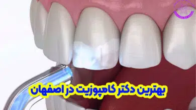 بهترین دکتر کامپوزیت دندان در اصفهان