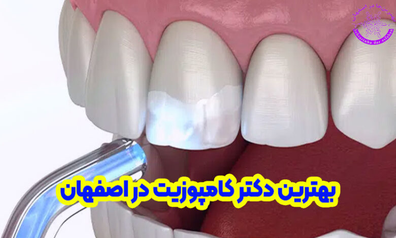 بهترین دکتر کامپوزیت دندان در اصفهان