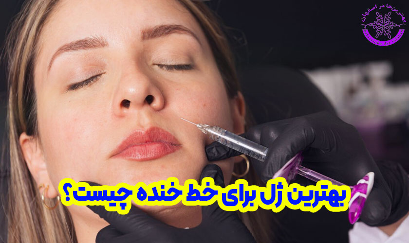 بهترین ژل برای خط خنده چیست